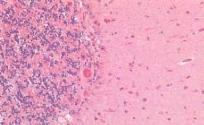 Immunohistochemistry-Paraffin: GAD65/67 Antibody [NBP3-14328]